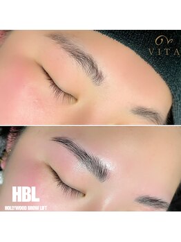 ヴィータ(VITA)/ハリウッドブロウリフト