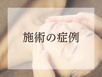 サロンキャン(Salon.CAN)/人気メニューの症例写真はこちら