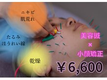 栄光治院 豊田院/リフトアップ美容鍼×小顔矯正