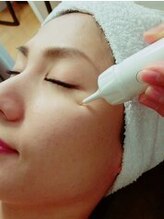 ダーマルラボ 福島店/シミケア