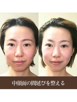 バンブー(bamboo)/童顔・若々しい印象へ