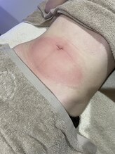 シャリテ(Charite)/冷却後のお腹