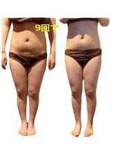 エステサロン ジュブリー/［ブライダル痩身］