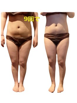 エステサロン ジュブリー/［ブライダル痩身］