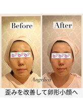 アンジェリカ(Angelica)/コルギ超え小顔矯正と筋膜ケア