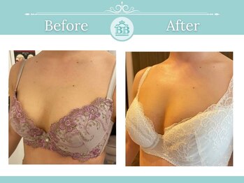 美人バスト 浜松店/◇ バストアップ &nbsp;BeforeAfter◇