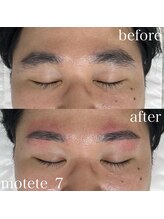 モテテ 名駅店(motete)/お客様施術例☆名駅