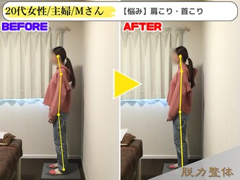 幸せのもり整体院/20代女性/主婦/Mさん