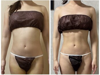 スリーピングビューティー(Sleeping Beauty)/