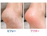 【一発解決!究極スッキリ】台湾式足つぼ×角質除去　経絡から内臓活性60分