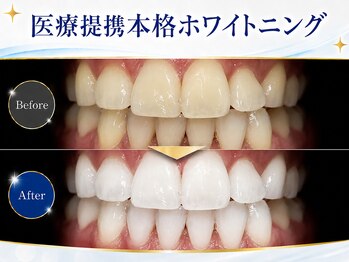 メルヴェイユ/本格医療提携ホワイトニング