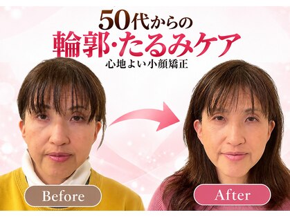 ラ キュート(LA-9TE)の写真
