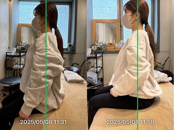 グレフル鍼灸接骨院 整体院 心斎橋/整体/肩こり/マッサージ/腰痛