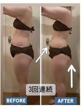 ヨサパーク レナータ(YOSA PARK Renata)/30代【痩身/冷え/毛穴】連続3回