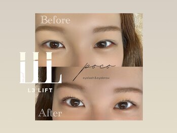 ポコ(poco)/L3リフト