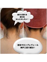 プレヴェール 神戸三宮/うなじ脱毛