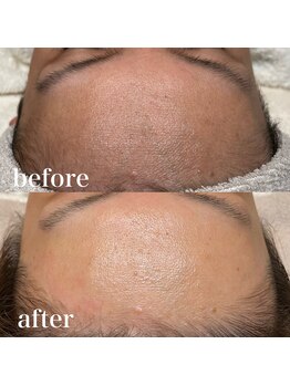 ビエル(VIERU)/フェイシャルワックス