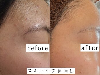 ユウビジン(YOU美人)/お肌に合ったスキンケア見直し