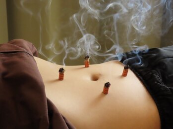 セラピア 札幌大通店の写真/「その不調、鍼灸で根本ケア。」歴20年以上の匠技で不調の原因に徹底アプローチ！疲れにくい整った身体へ★