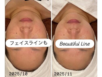 トータルエステティック ジョワイユ(JOYEUX)/あきらめないで！STOP肌老化！