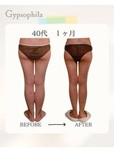 ジプソフィラ(Gypsophila)/痩身ビフォーアフター