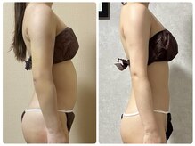 スリーピングビューティー(Sleeping Beauty)/