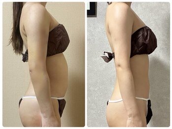 スリーピングビューティー(Sleeping Beauty)/