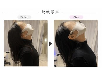 リラボ整体院 麻布十番店(RE+LAB=◯整体院)の写真/国家資格者による一時的ではない根本改善を。/麻布/麻布十番/赤阪/赤阪見附/整体/小顔