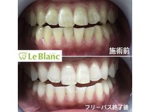 ルブラン 奈良店(Le Blanc)/初回の方電動歯ブラシプレゼント