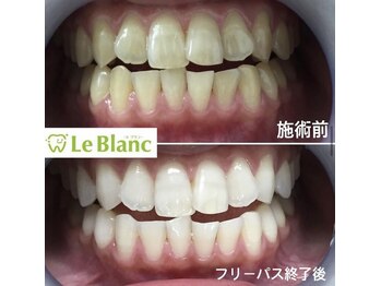ルブラン 奈良店(Le Blanc)/初回の方電動歯ブラシプレゼント