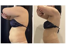 ビューティー アディクト(Beauty addict)/効果絶大！大人気のセルゼロ