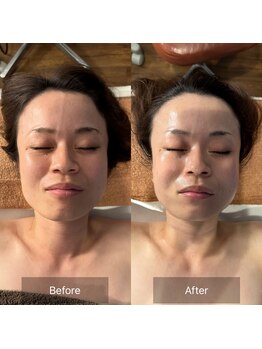 フフラ KANコルギセラピー山梨本店(fufla)/コルギ&頭皮筋膜リフト+3D小顔