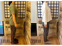 整体院リノベボディ(リノベBODY)/幼少期からの腰痛と肩甲骨痛改善