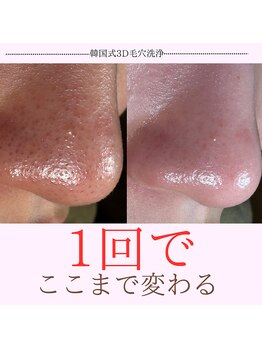 リエット(Lieto)/