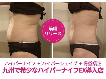 骨盤ダイエットサロン カンフリエ(camphrier)の写真