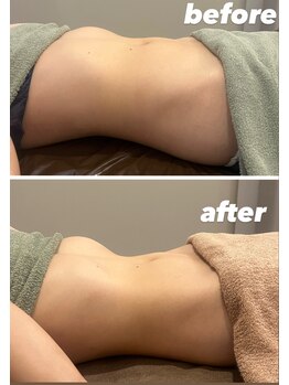 ユヴィラ(YUVIRA)/大人気の腸もみ♪