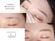 イデアル(ideal)の写真