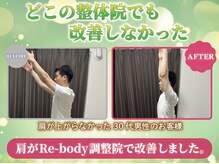 リボディ調整院 上野(Re-body調整院)の雰囲気（どこの整体院でも改善しなかった肩が当院で改善しました）