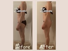 レモン(Lemon)/ビフォーアフター