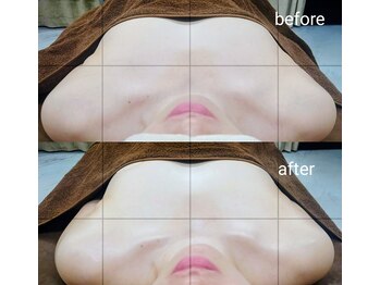 アンドボディ 横浜元町(&Body)/巻き肩矯正と肩幅の調整