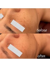 リノ(Lino)/気になるシミ、お任せください！