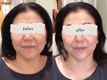 ボン セジュール(Bon sejour)/レモンボトル