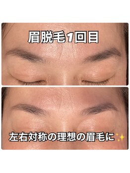 リエル(RIEL)/眉脱毛