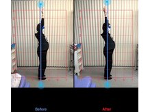 りらく整体 あおば/妊娠時の肩こりにアプローチ