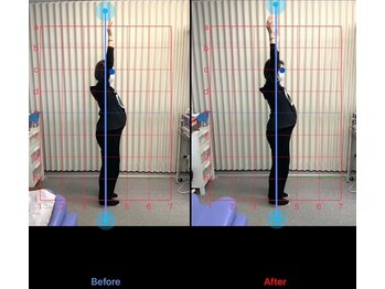 りらく整体 あおば/妊娠時の肩こりにアプローチ