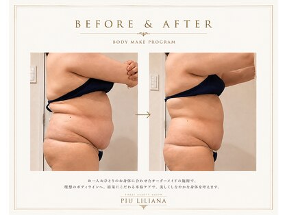 ピュウリリアーナ(Piu liliana)の写真