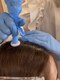 サロン ド シュシュの写真/《プロセルセラピーズ【頭皮ケア】》頭皮ケアを行うことで育毛を促す効果も！カウンセリングクーポン◎