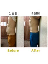 マリモ鍼灸接骨院/電磁パルス週1回　8回目の結果