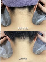 クライム(CLIMB)/施術経過