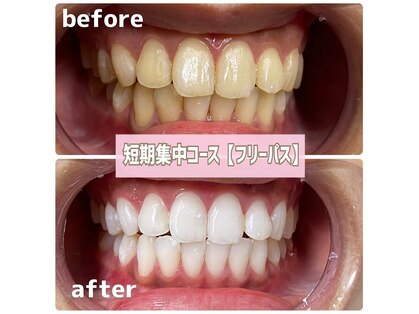 ビーホワイト 名古屋金山店(BE WHITE)の写真